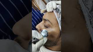 Oxygen Infusion Facial #Aesthetician