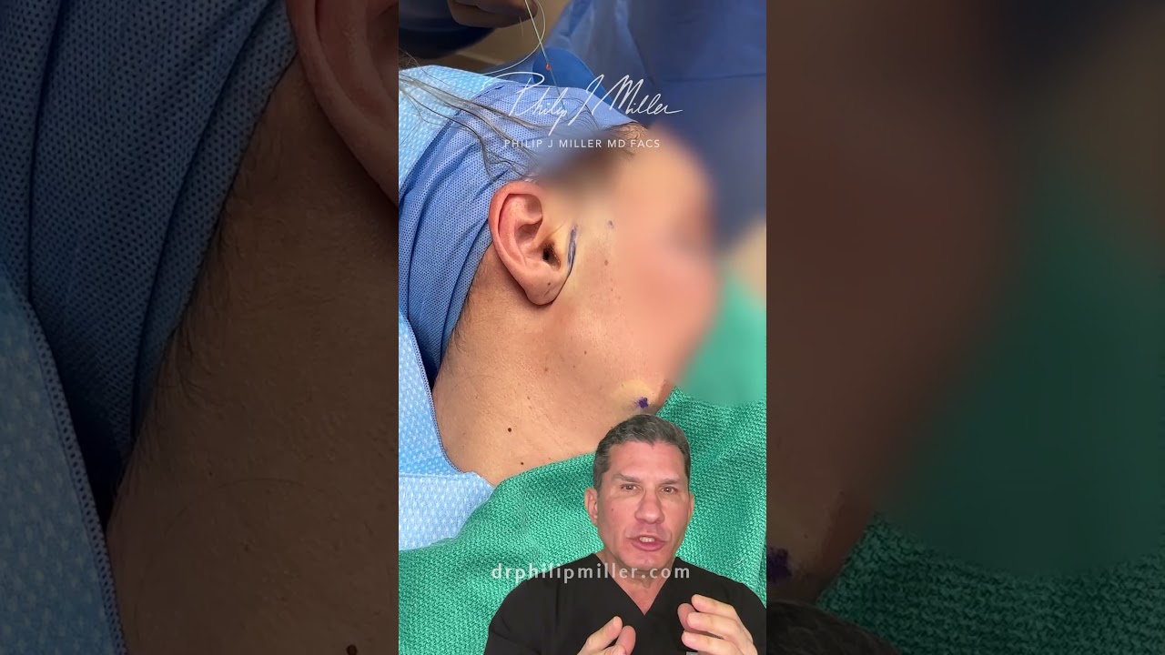 Microlift-Face&Neck!