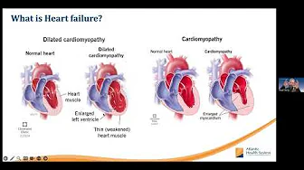 From Heart Failure to Heart Success