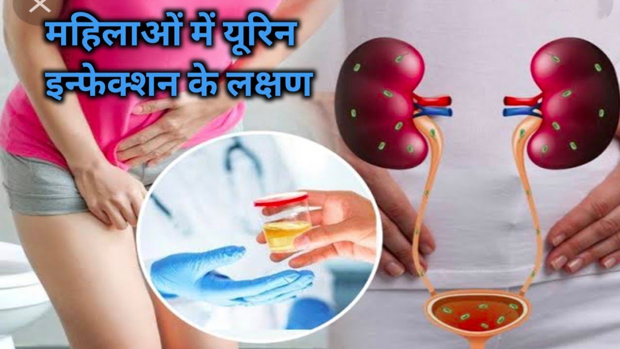 mahilaon mein urin infection ke lakshan, aur Karan,महिलाओं में यूरिन ...