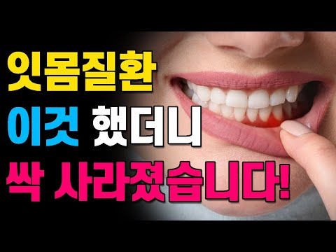 [잇몸치료] 잇몸질환 &rsquo;이렇게 했더니&rsquo; 싹 사라졌습니다!! 잇몸 질환에 도움 되는 7가지 자연요법!!