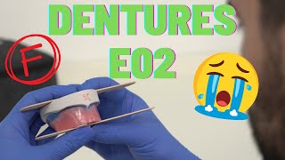 Do we suck at Dentures? | ACE diploma Journey E02 by Two Dentists 2,041 views 1 year ago 9 minutes, 13 seconds