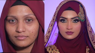 HOW TO COVER ACNE & SCARS EASILY | BRIDAL MAKEUP WITH HIJAB | Quick Simple and Easy screenshot 4