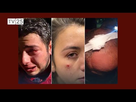 აქციაზე მედიის წარმომადგენლები დაშავდნენ