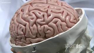 Blood test helping diagnose concussions