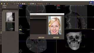 DDS Pro 030   Adding and editing pictures