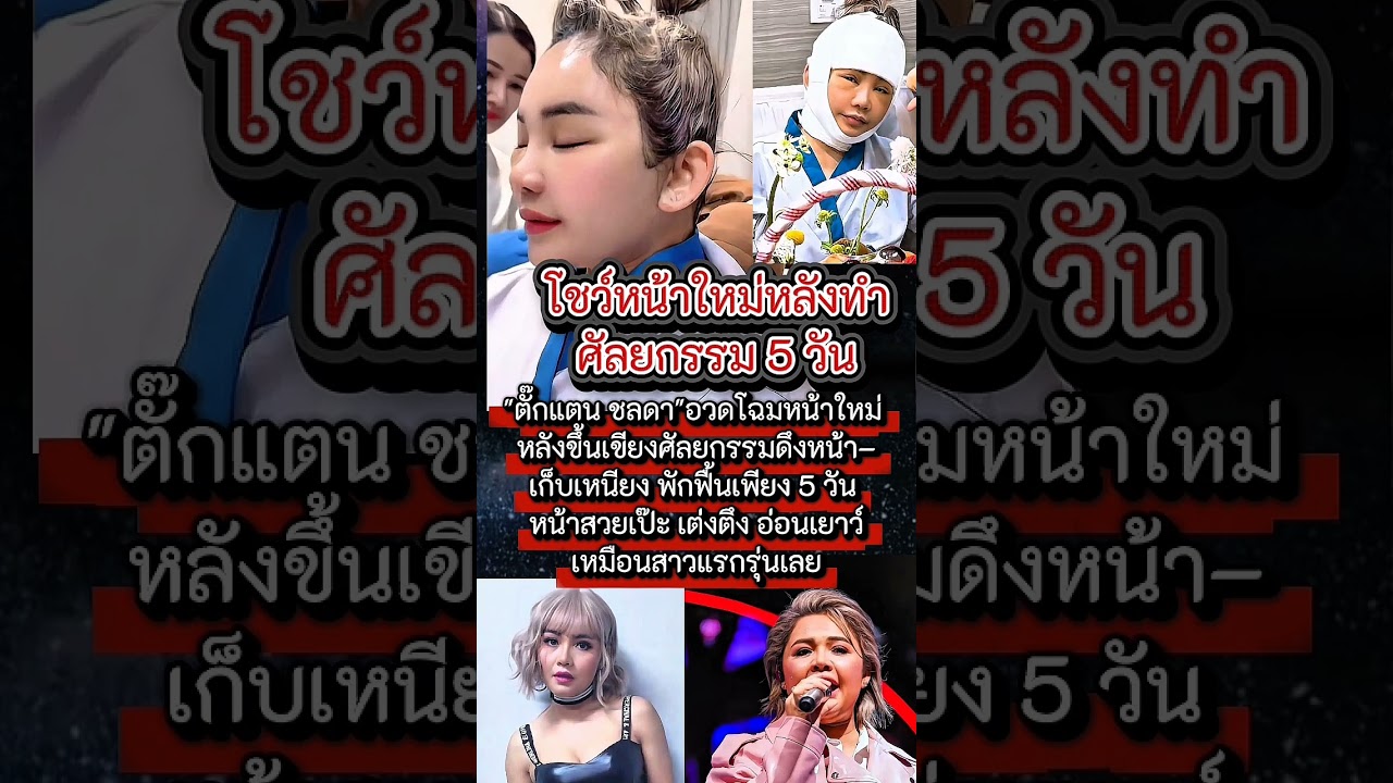 โชว์หน้าใหม่#ตั๊กแตนชลดา #ศัลยกรรม #ข่าวบันเทิง #นักแสดง #ข่าวดารา #นักร้อง