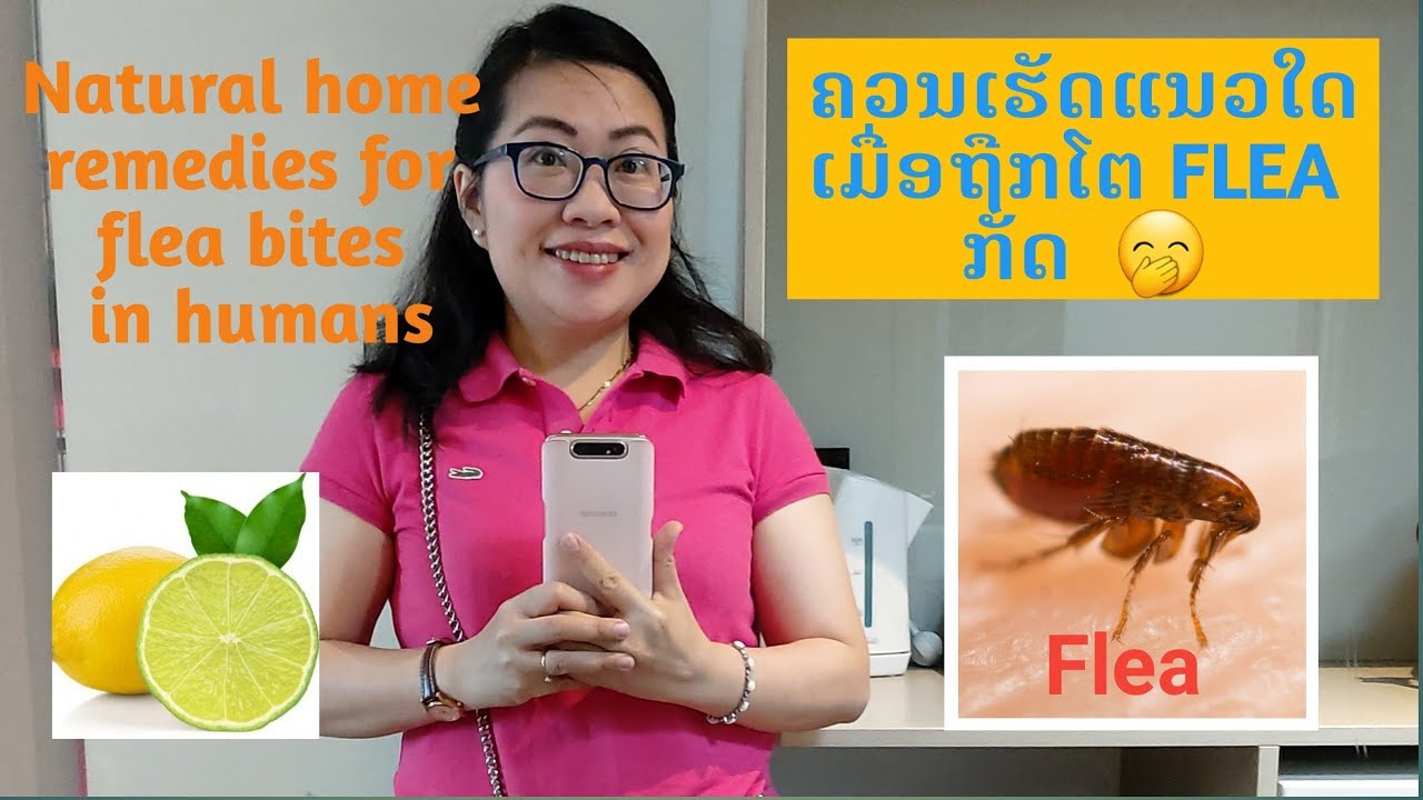 New Zealand 2019 Ep3 Natural Home Remedies For Flea Bites In Humans À»àº¡ Àº­àº Àº Flea Àº Àº Àºàº§àºà»àº® Àºà»àºàº§à»àº Youtube
