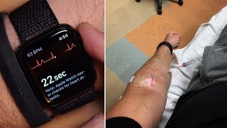 How an Apple Watch ECG Led Me To The Emergency Room