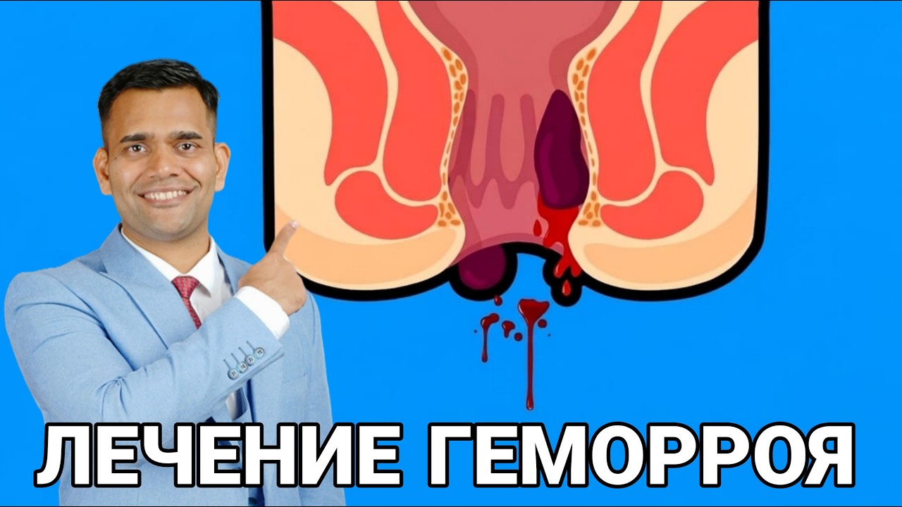 Можно Вылечить Геморрой Анальным Сексом Можно Вылечить Геморрой Анальным Сексом
