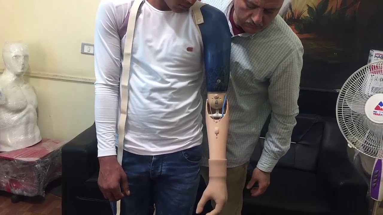 طرف صناعى فوق الكوع كف متحرك يد متحركة