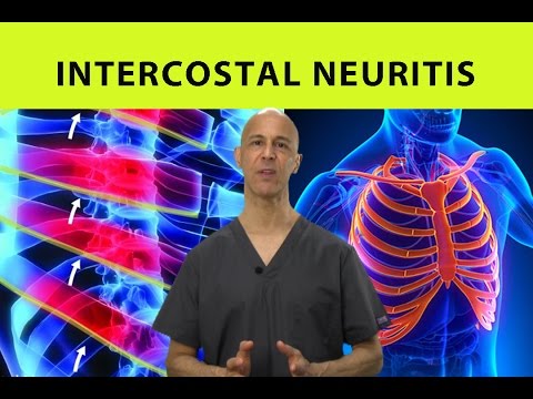Video: Intercostal Neuralgia - Symptoms, Treatment, Causes, Signs