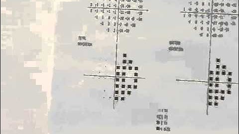 Formal Visual Field Testing