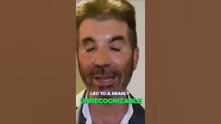 The Tragic Plastic Surgery of Simon Cowell