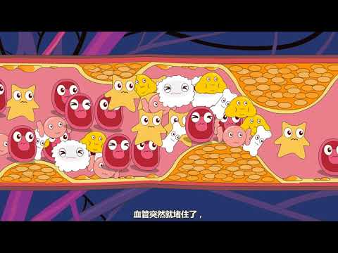 拿什么拯救你的血管老化？