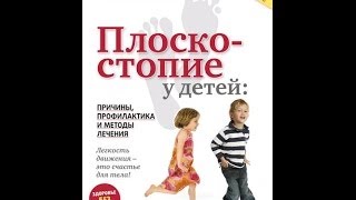 ПЛОСКОСТОПИЕ У ДЕТЕЙ: причины, профилактика и методы лечения. ПЛОСКОСТОПИЕ У ДЕТЕЙ: причины, профилактика и методы лечения.