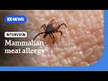 What is mammalian meat allergy and what role do ticks play? | ABC NEWS