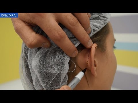 Video: Plastična operacija skozi oči moškega