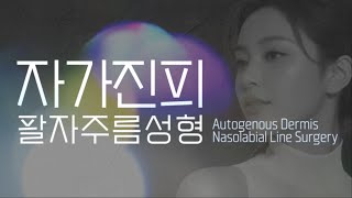 ✨홍닥터의 팔자주름 치트키✨  프레쉬 자가진피성형 팔자주름 /자가진피