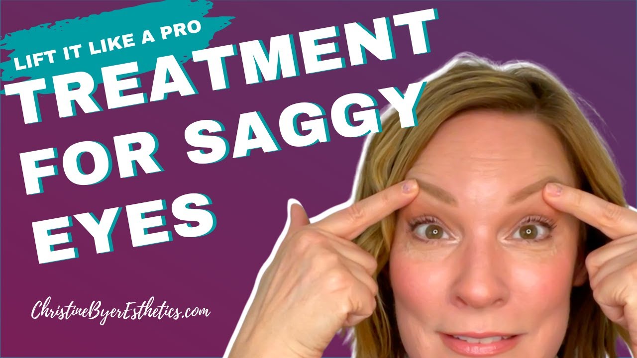 Chatty Eye Treatment & the Stupid thing I did in Paris