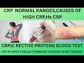 CRP(C REACTIVE PROTEIN).CRP BLOOD TEST.NORMAL RANGE,CAUSES OF HIGH CRP,Hs CRP ,HOW TO REDUCE CRP?