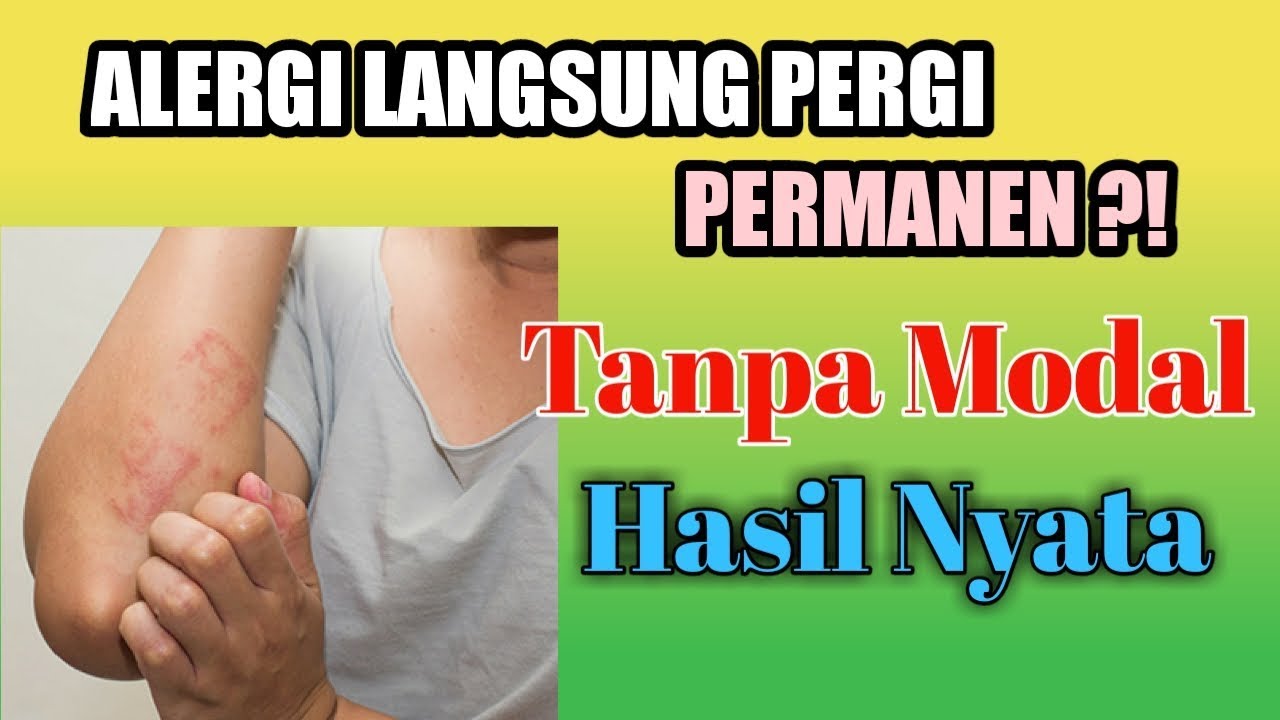 BIKIN TERKEJUT !!! Begini Cara Alami Mengobati Alergi ! Obat Alergi