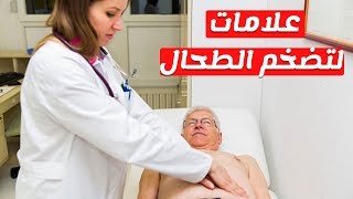 ماهي علامات واعراض تضخم الطحال وكيفيه العلاج سريعا؟