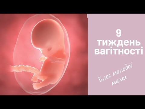 9 тиждень вагітності / 9 неделя беременности