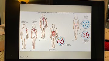 Chapter 14/15 Part 3🤧🧫🦠🤒