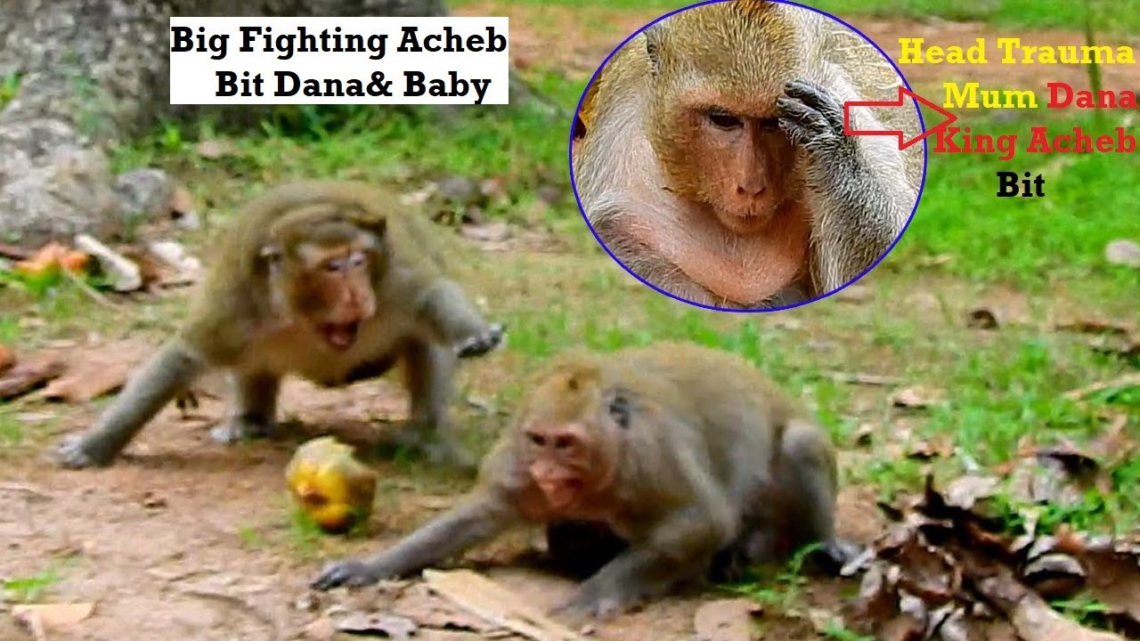Find Real Reason!Why King Acheb Bit Mum Dana And Baby So Hurt/ Mum Has Head Trauma  After Acheb Bit