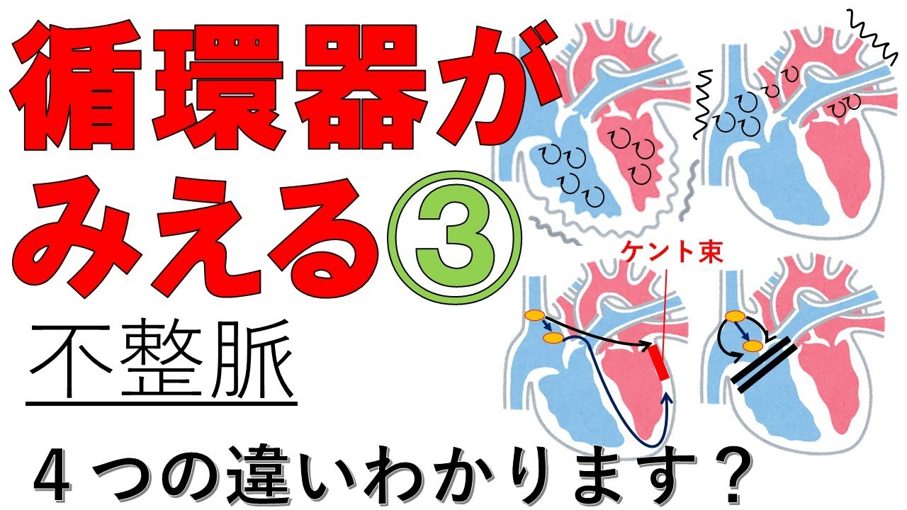 【不整脈】不整脈の種類、病態、治療薬　整理したい方はコチラ　医療系学生必見