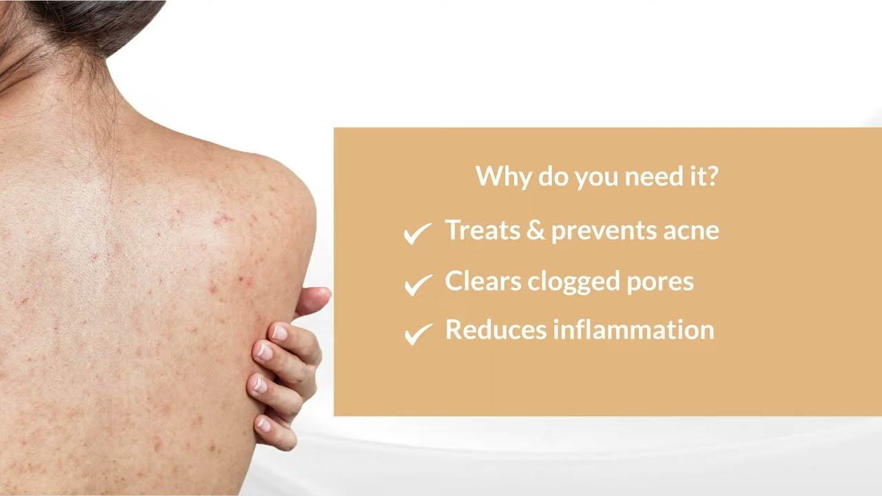 Body wash to get rid of Back and Body Acne