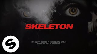 Matt Hawk - Skeleton Official Audio