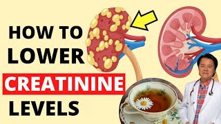 How To Lower Creatinine Levels : Tips for Kidney Disease  By Doc Willie Ong #1364