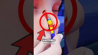 This Lego STUCK on his Nose For 26 YEARS😱 #shorts