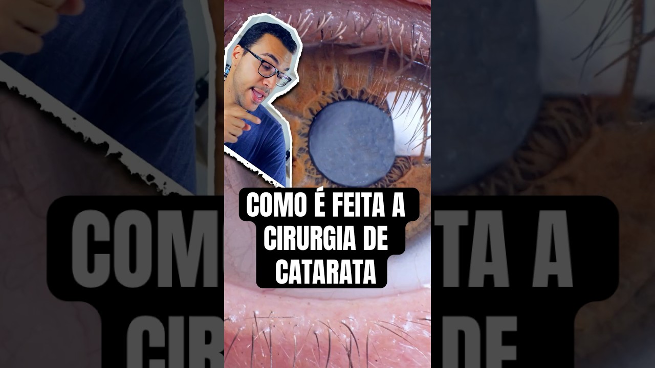 Como é Feita a CIRURGIA de CATARATA?