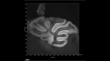 Macro confocal imaging of a mouse cerebellum
