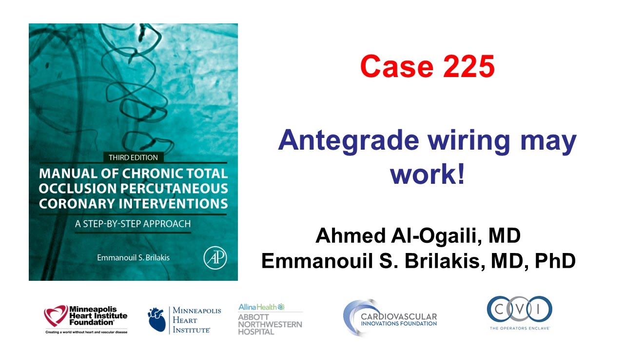 Case 225: Manual of CTO PCI - antegrade wiring works