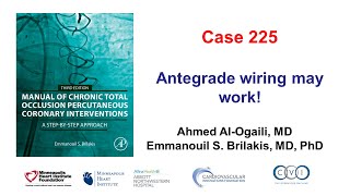 Case 225: Manual of CTO PCI - antegrade wiring works