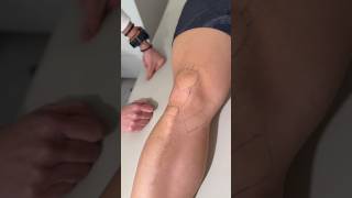 Palpatory Anatomy of the Knee Palpatory Anatomy of the Knee
