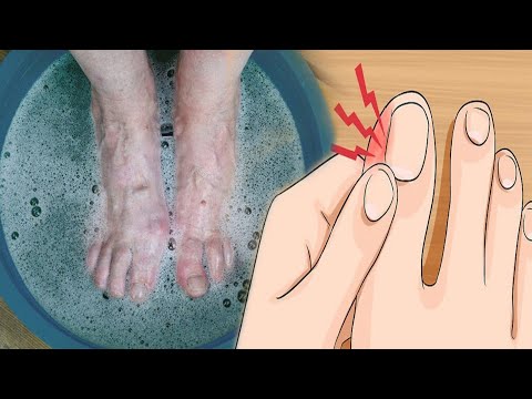 Video: Si të kujdeseni për thonjtë e këmbëve (me fotografi)