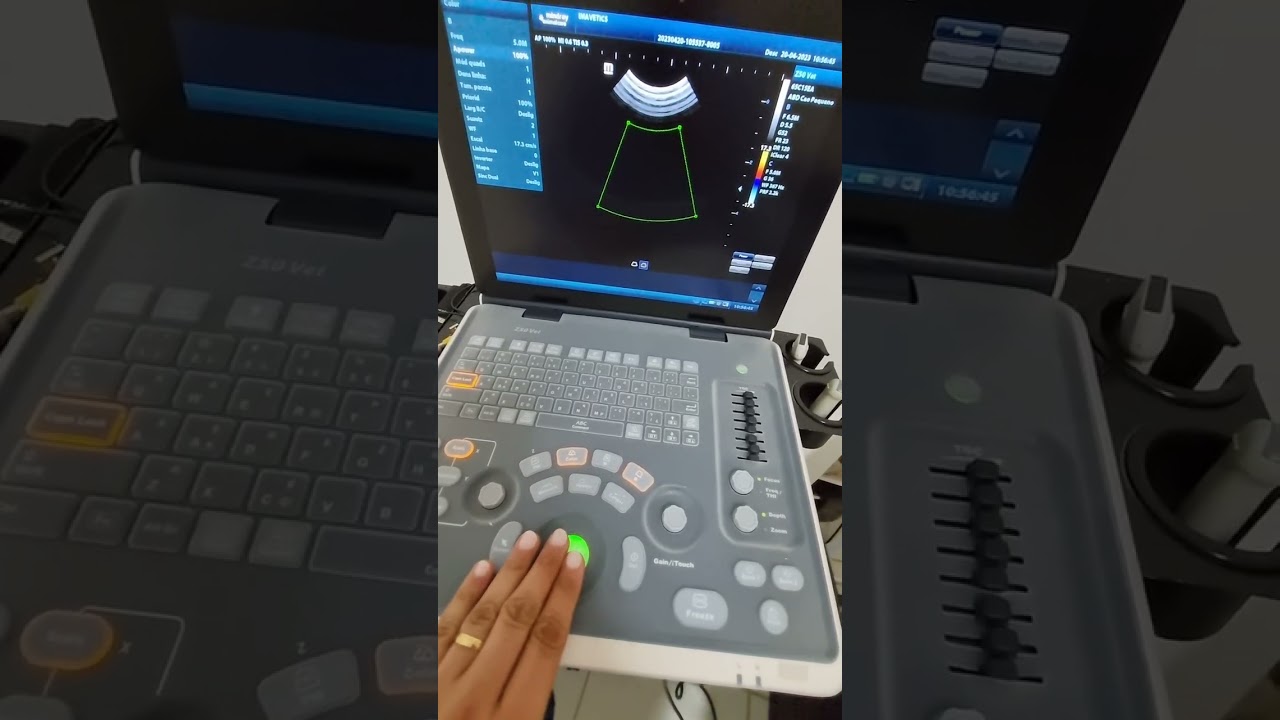 Acionando Doppler Colorido e Power Doppler no Z50 da Mindray