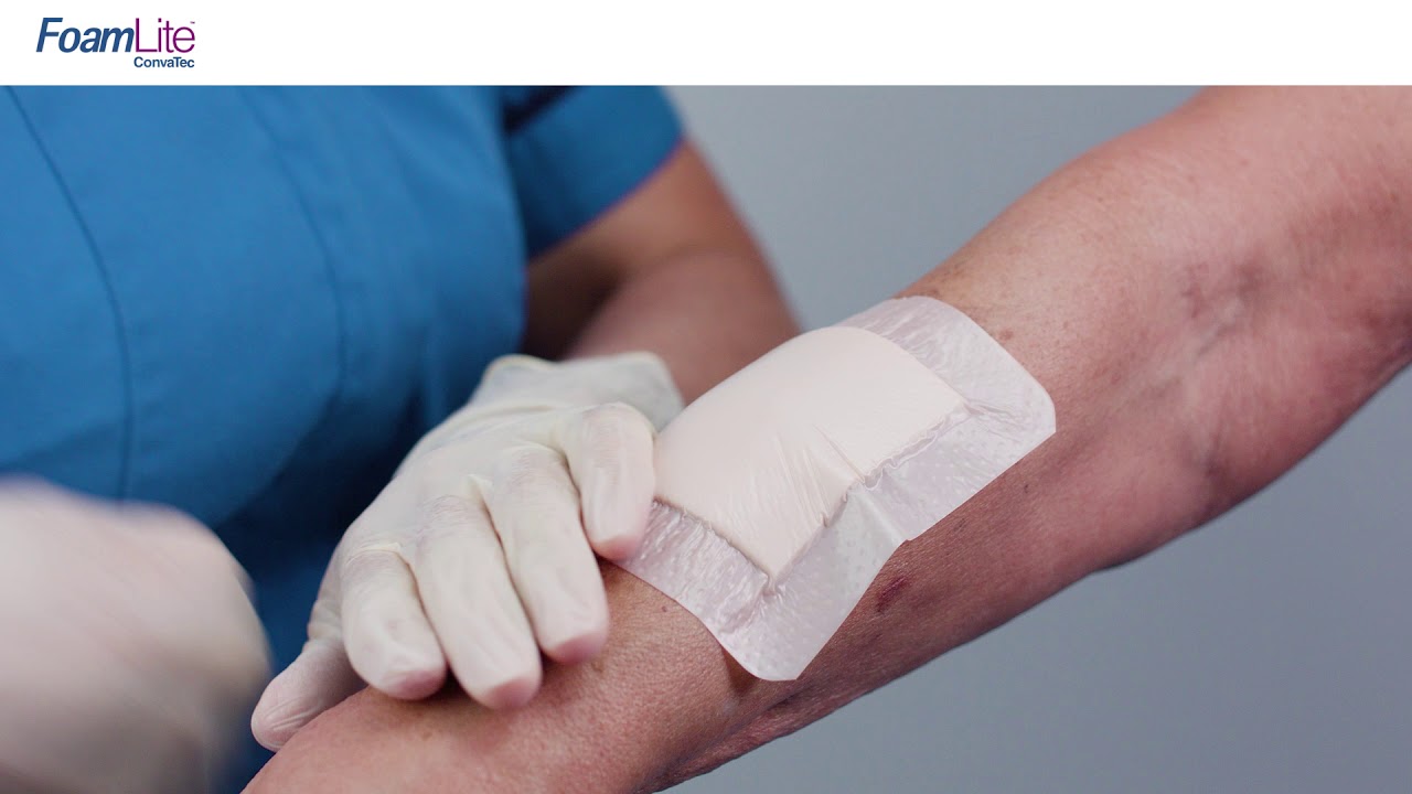 Foam Lite™ ConvaTec Application Skin Tear Mid Forearm YouTube