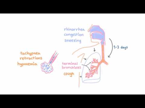 Video: Rozdíl Mezi RSV A Bronchiolitidou