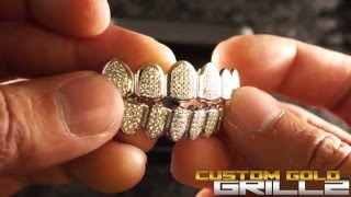 Check out these premium solid .925 sterling silver cz grills by custom
gold grillz. they are made from instead of being plated and is f...