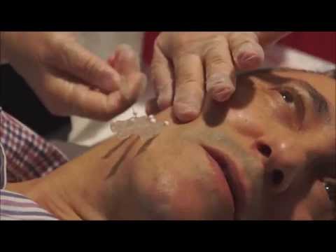 Video: Behandling Av Livmoderfibrer Utan Kirurgi - 3 Moderna Metoder