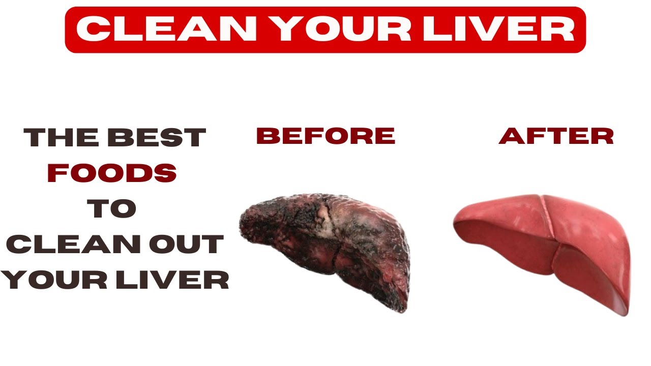 HOW TO DETOX YOUR LIVER BEST FOODS TO CLEAN OUT YOUR LIVER DETOX