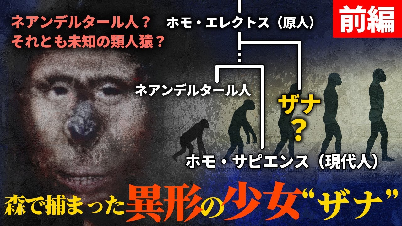 DNA解析で判明した“獣人少女ザナ”の正体とは？19世紀コーカサスの衝撃実話「前編」