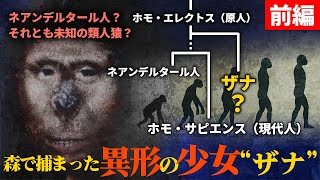 DNA解析で判明した“獣人少女ザナ”の正体とは？19世紀コーカサスの衝撃実話「前編」