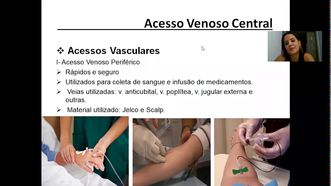 Acesso Venoso Central I - YouTube
